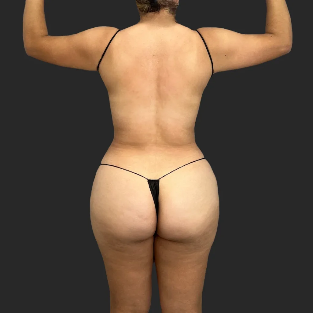 After image