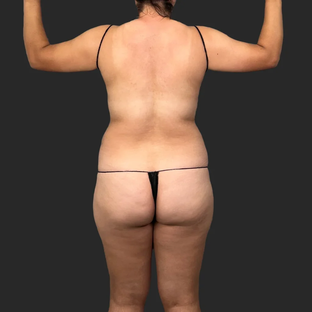 Before image