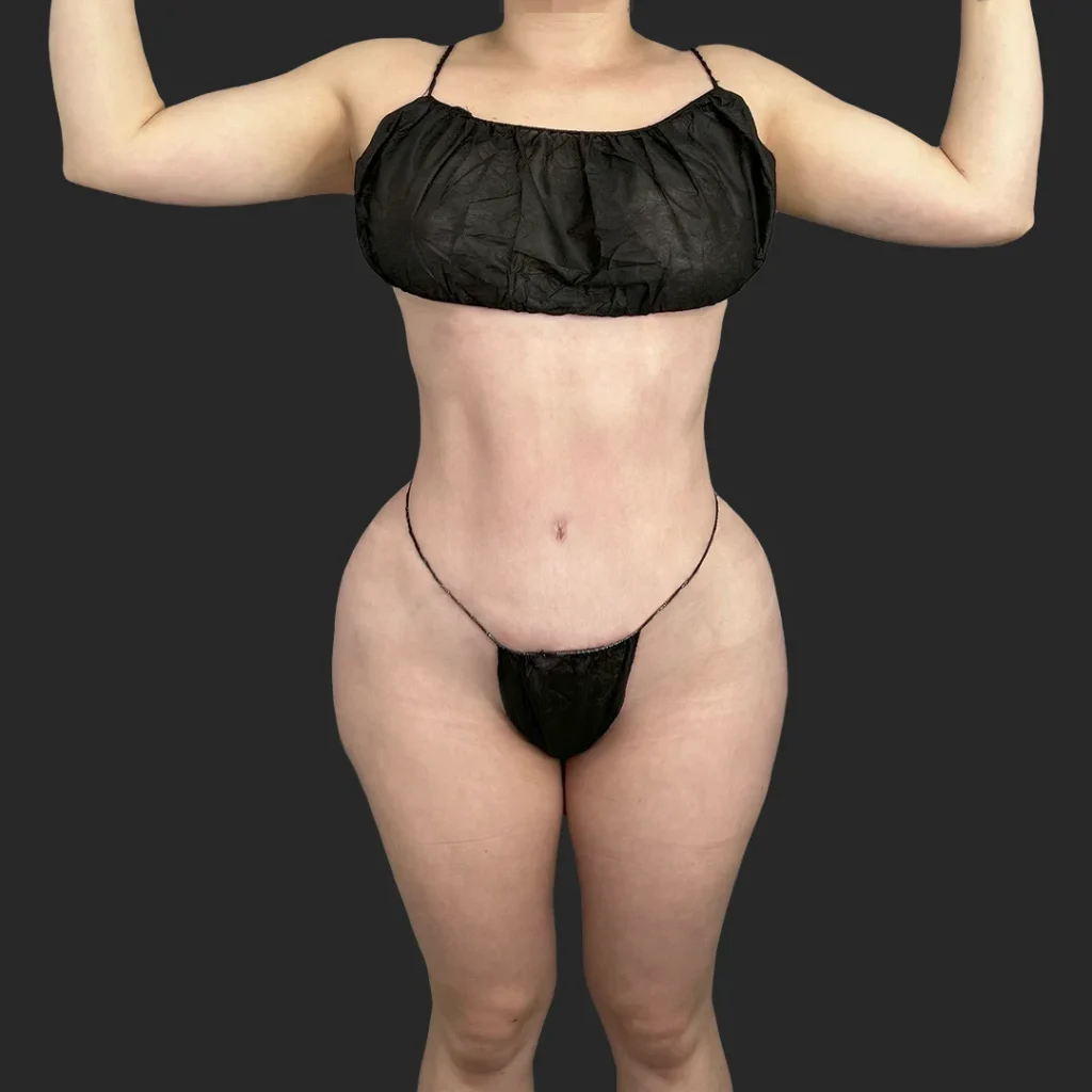 After image