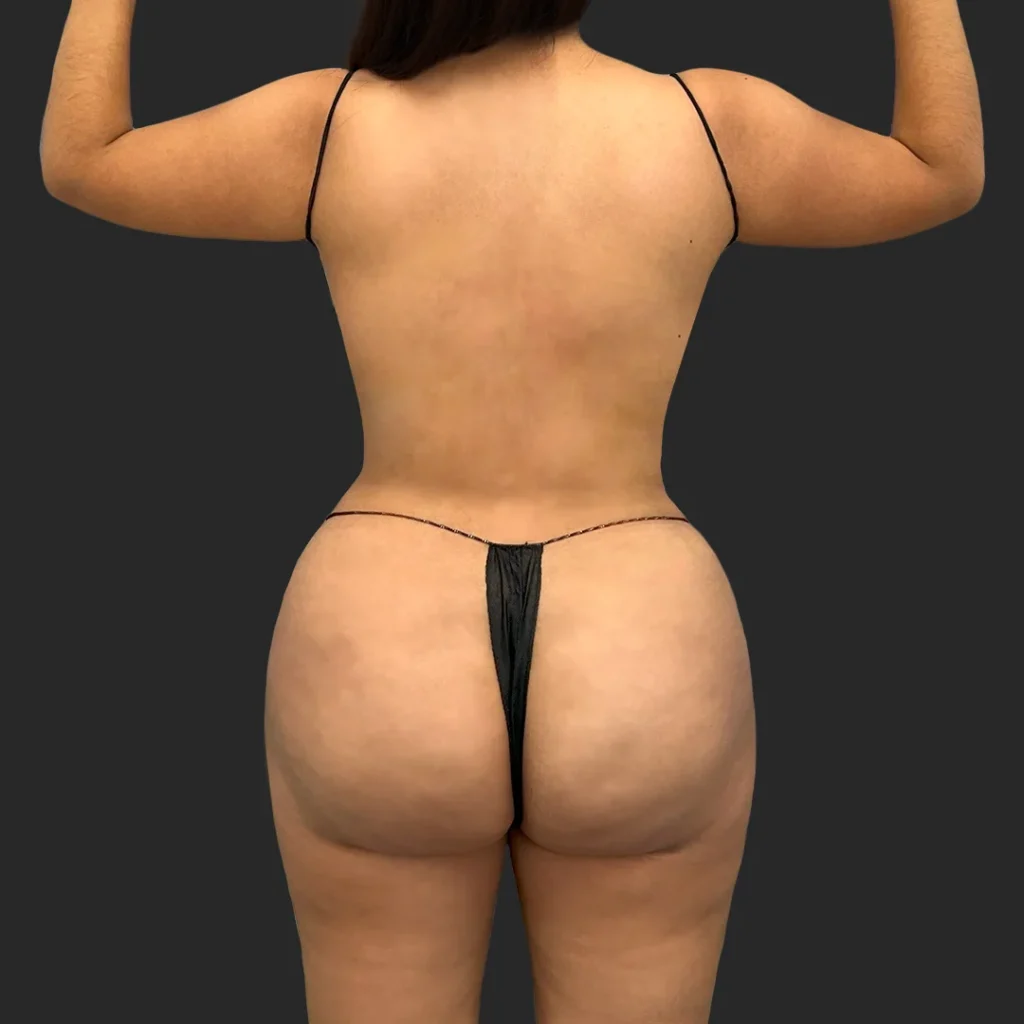 After image