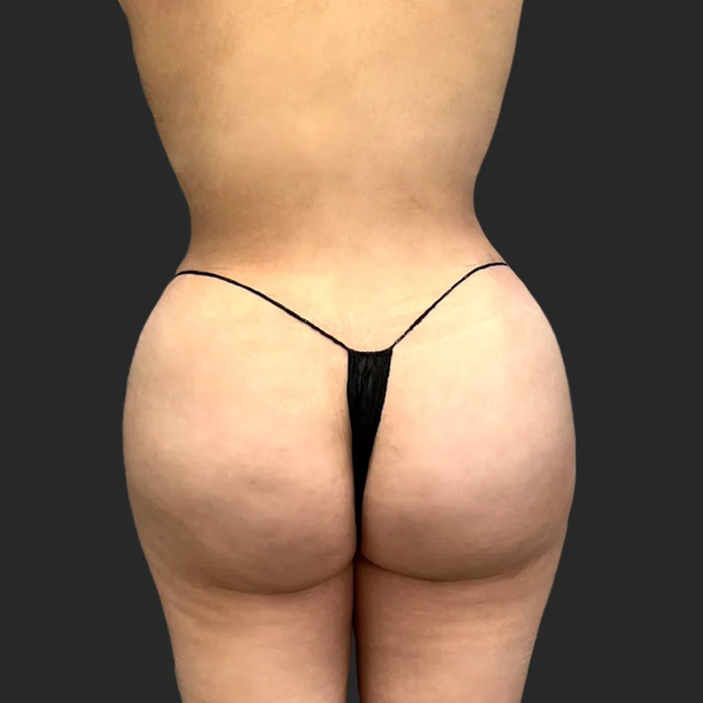 After image