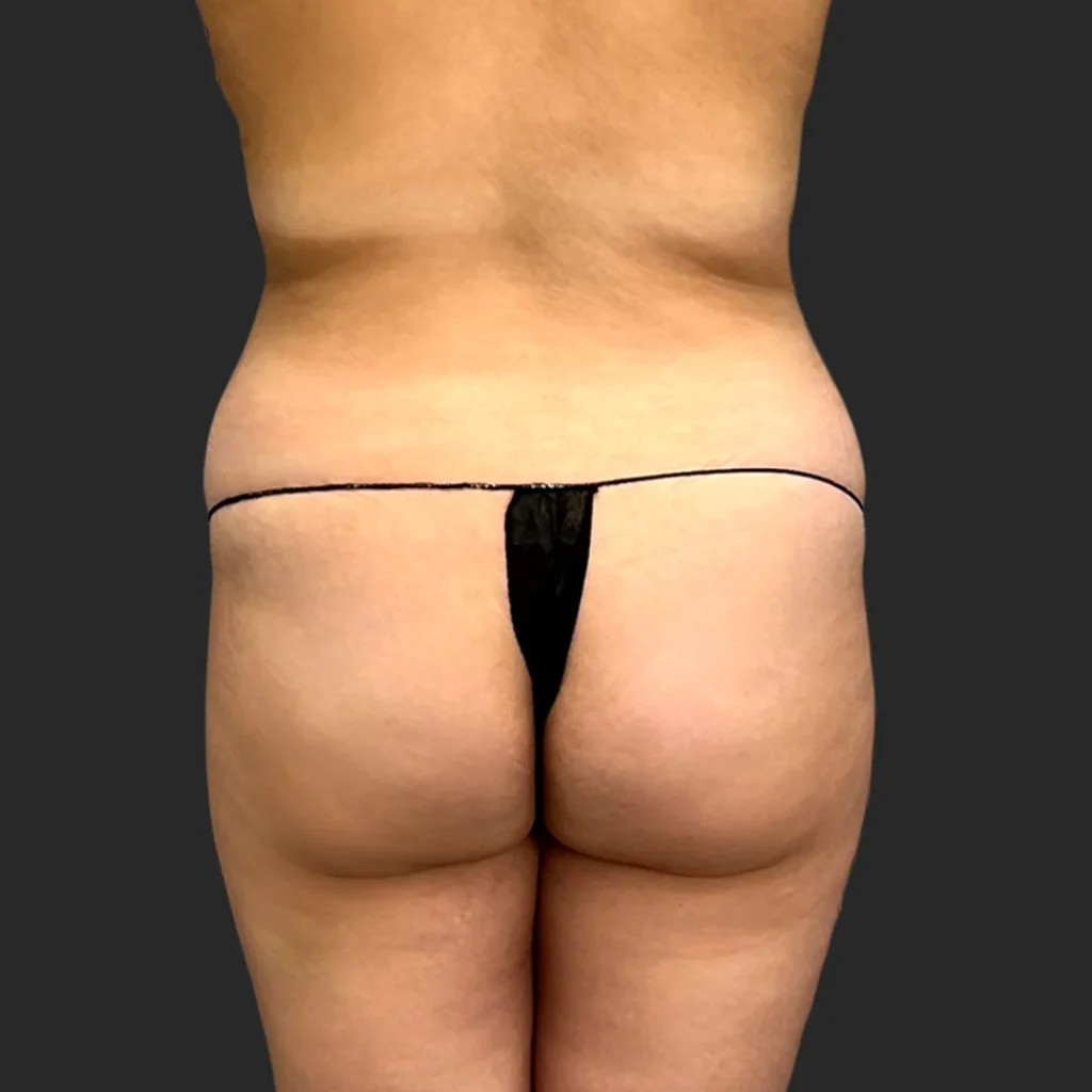 Before image