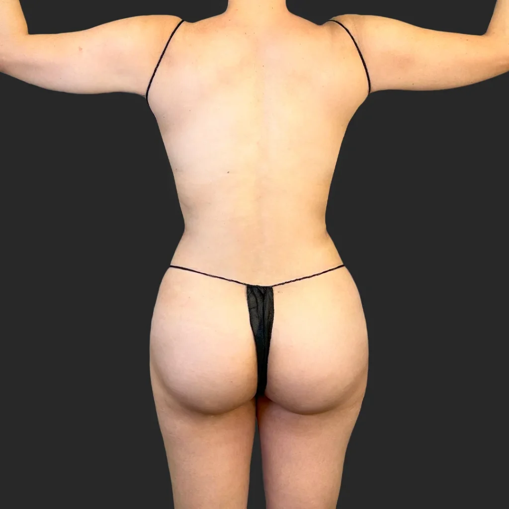 After image