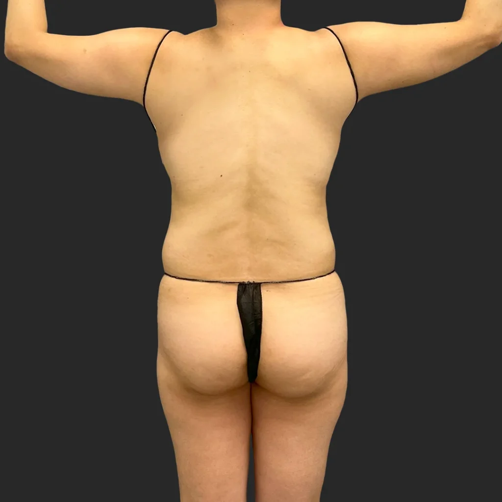 Before image