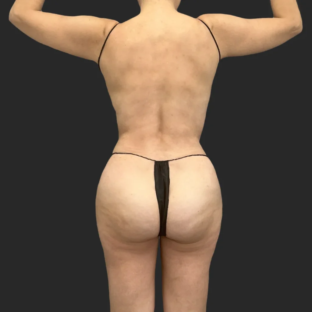 After image
