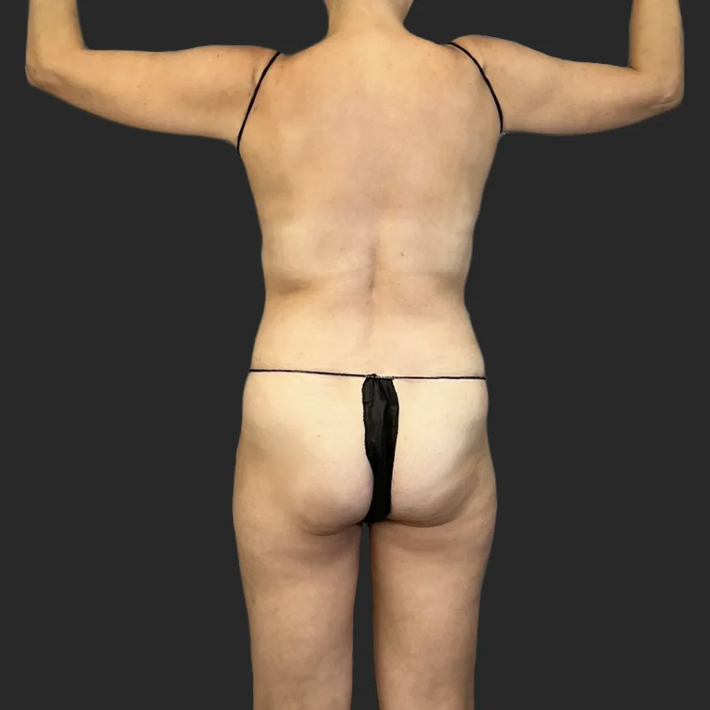 Before image