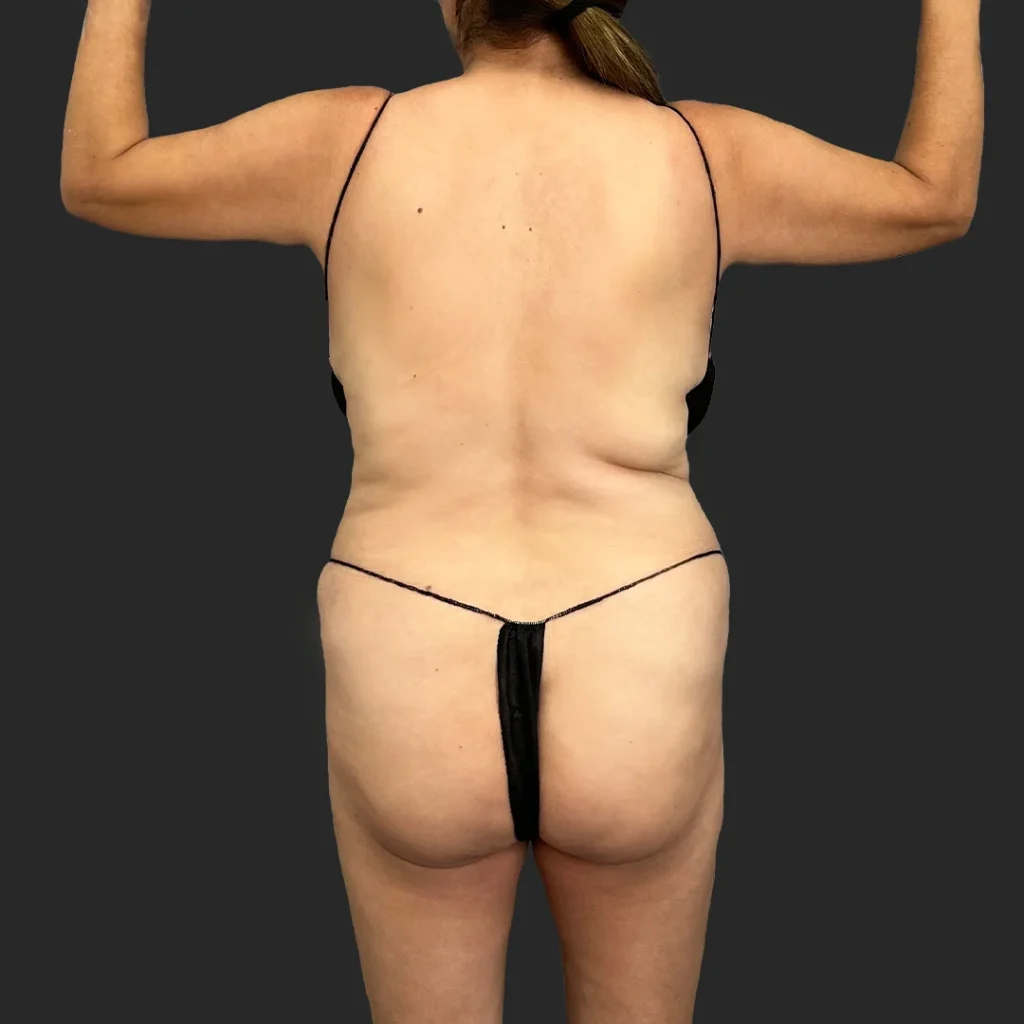 Before image