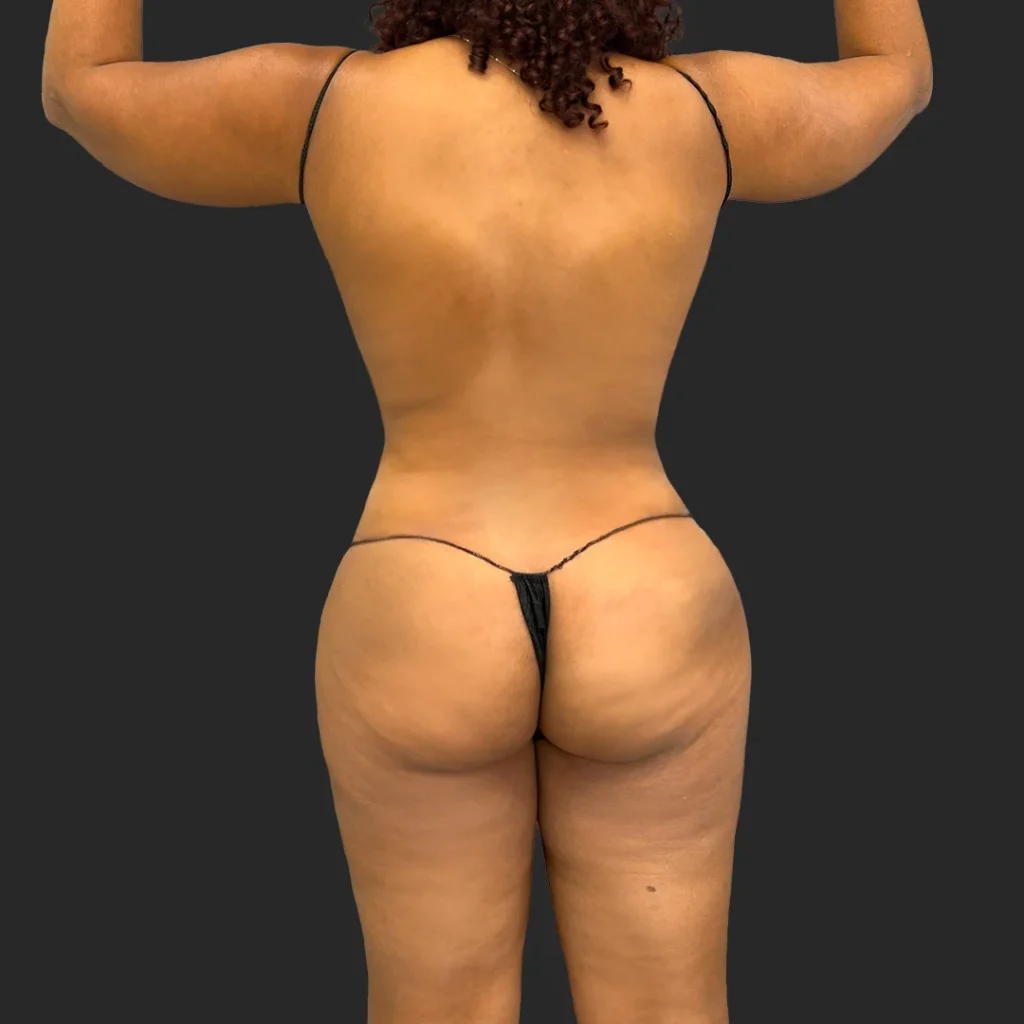 After image