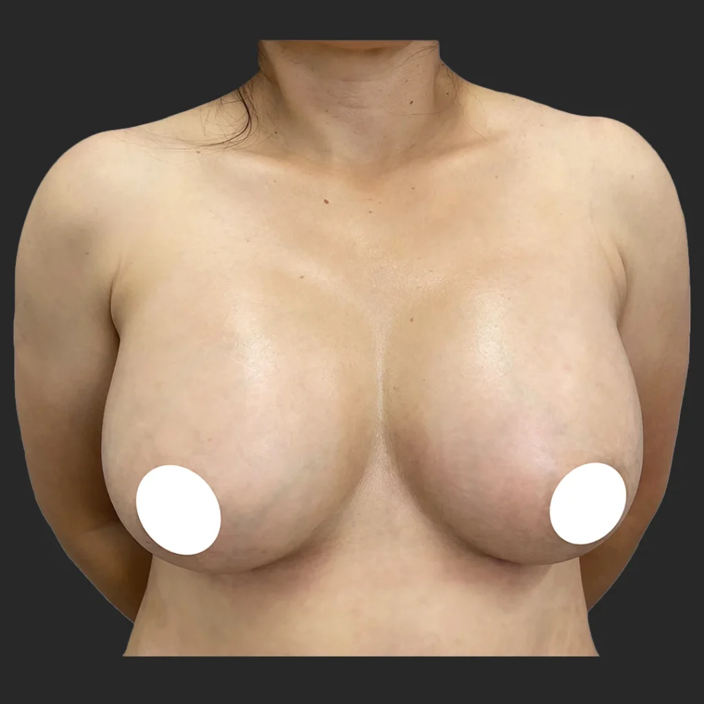 After image