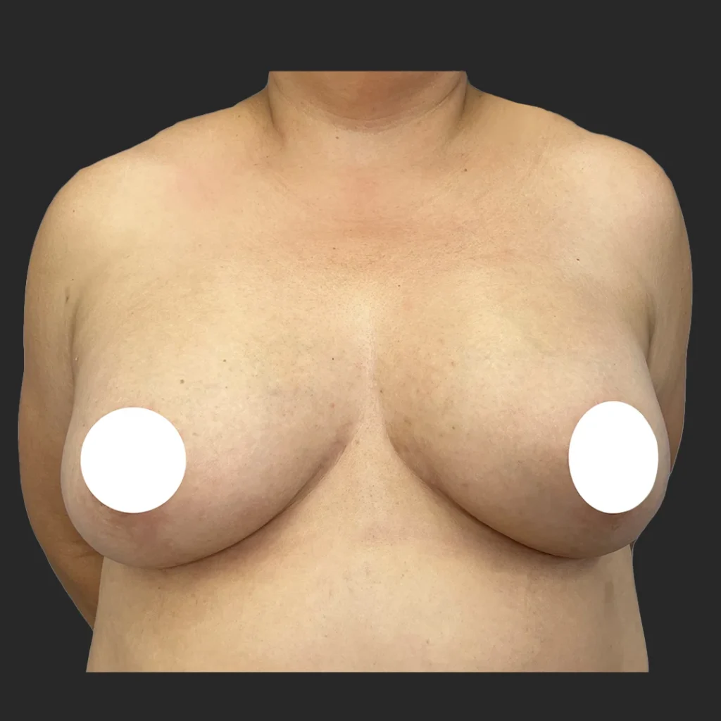 After image