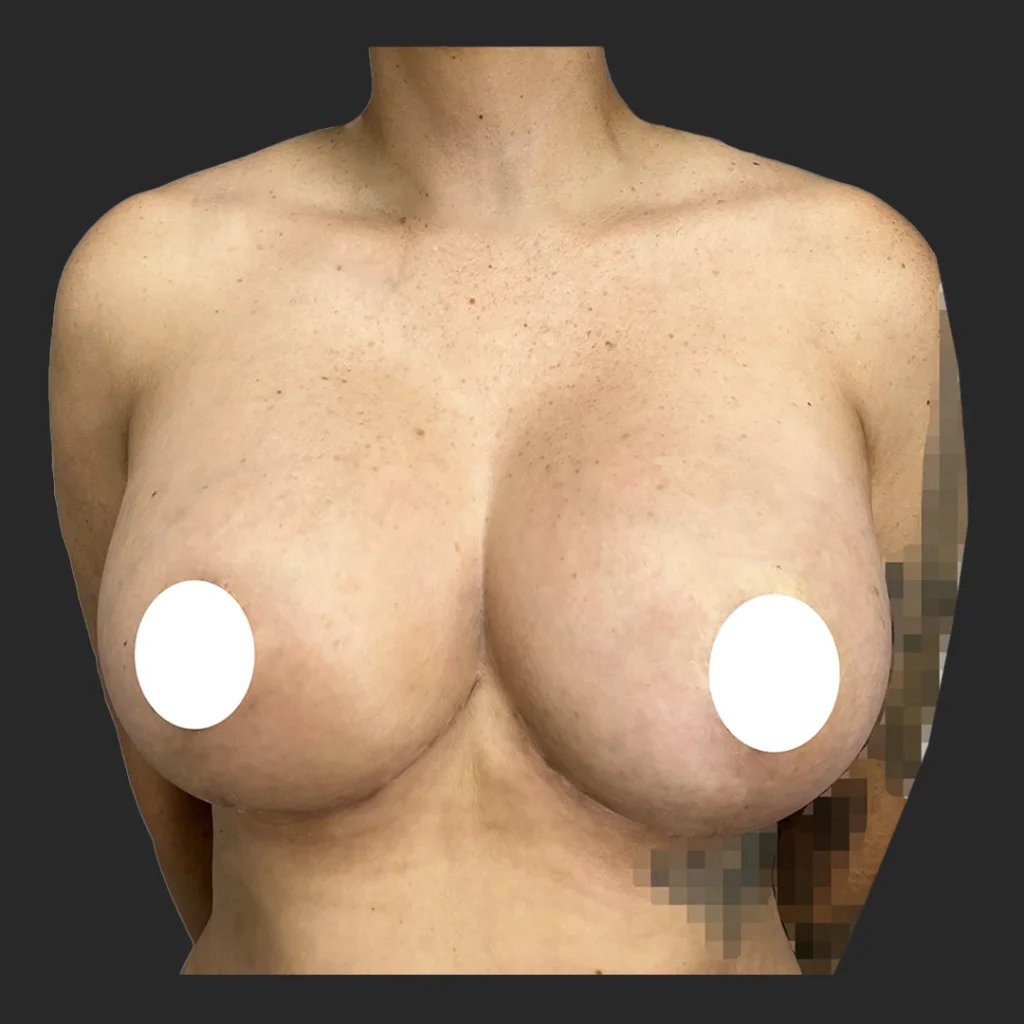 After image