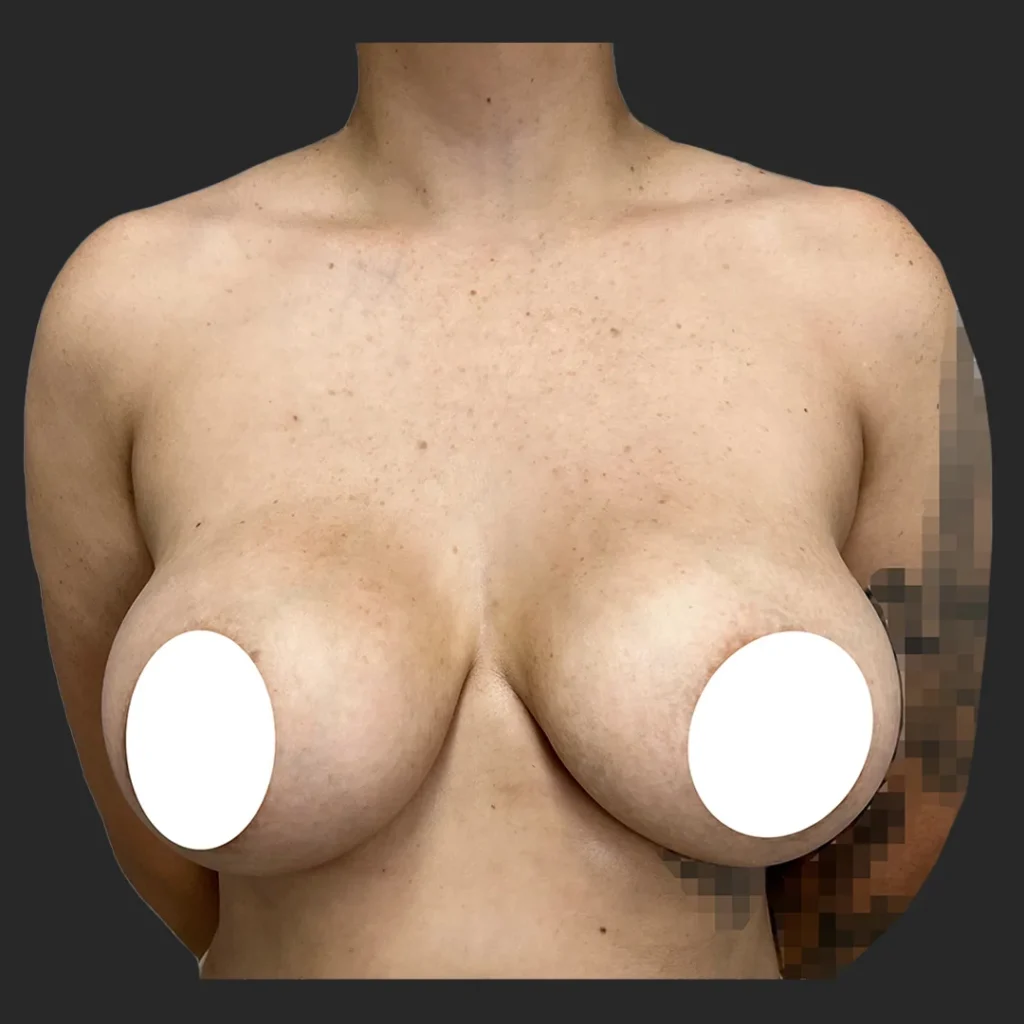 Before image