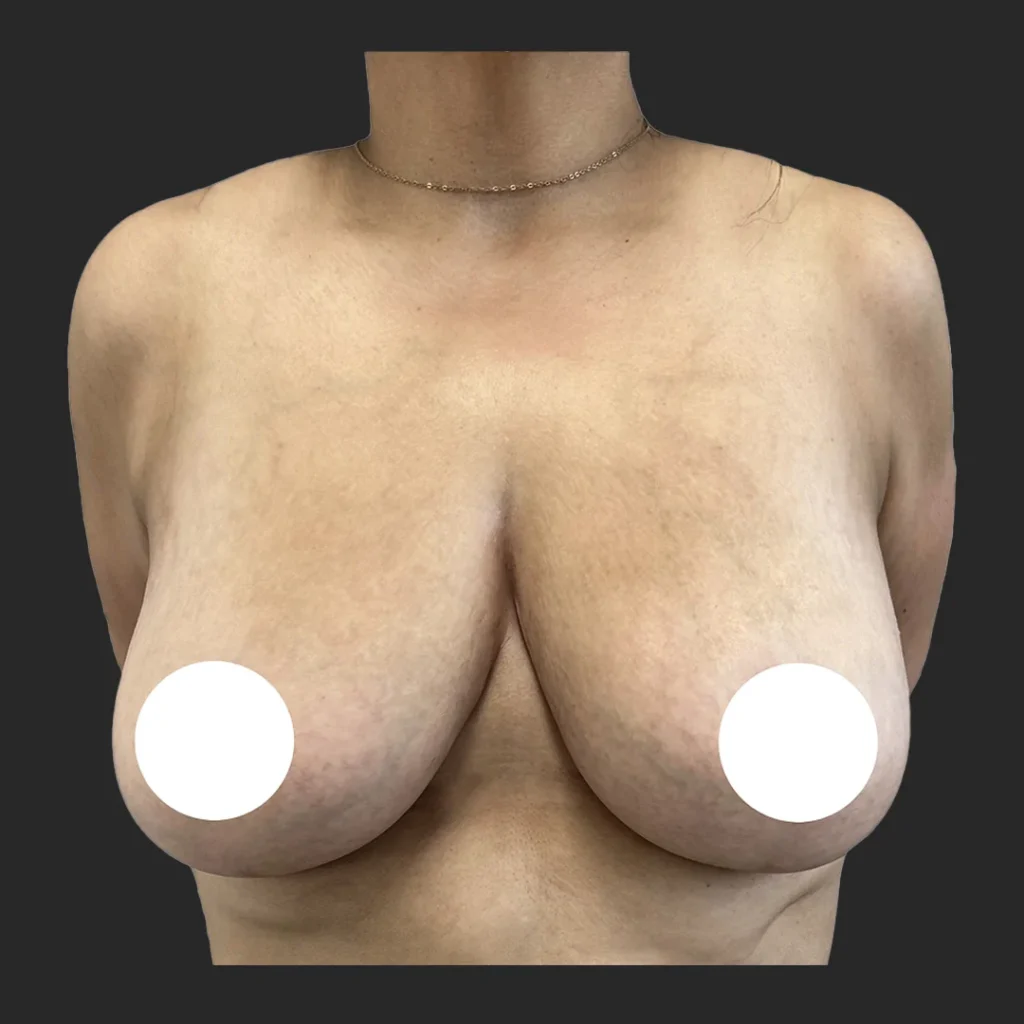 After image