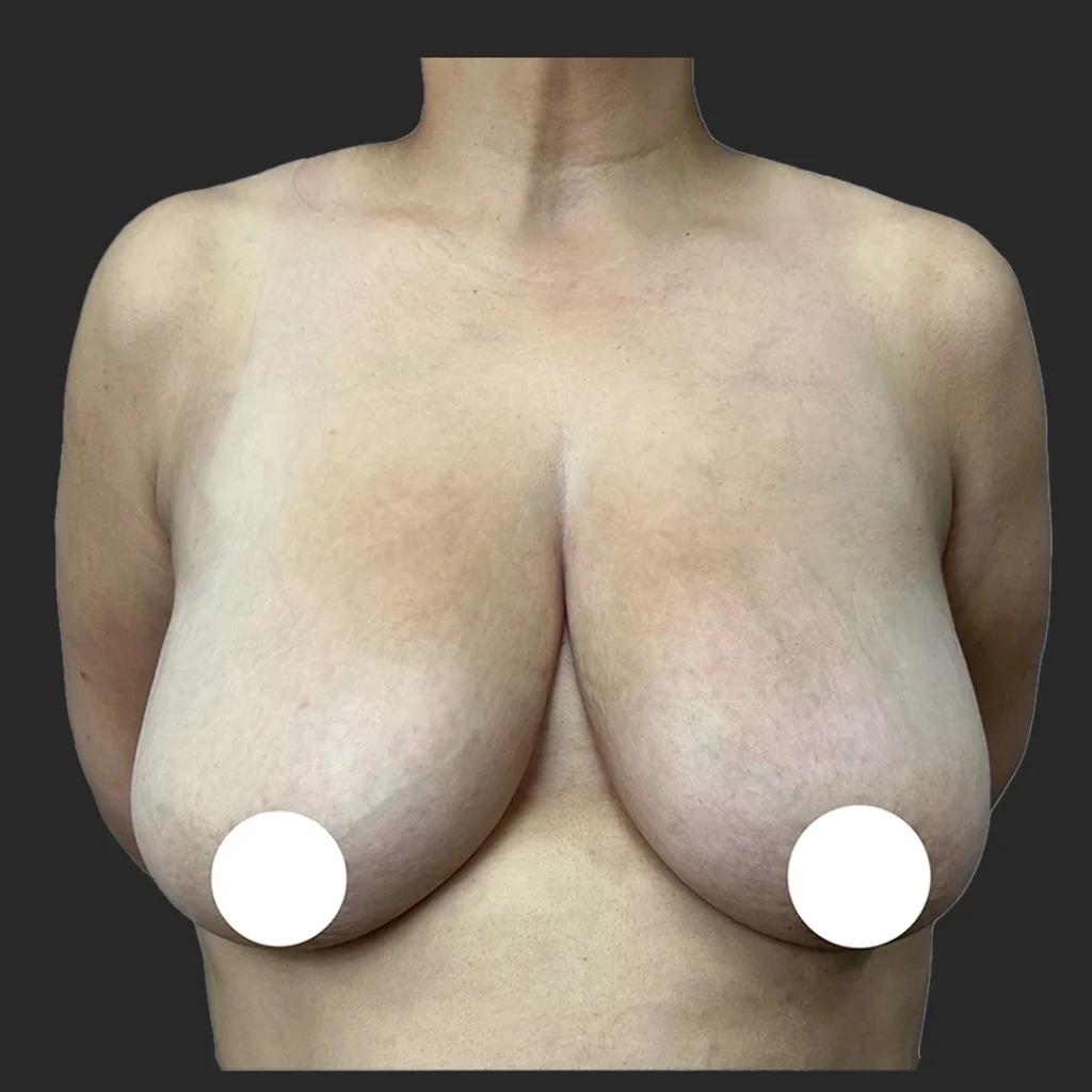 Before image