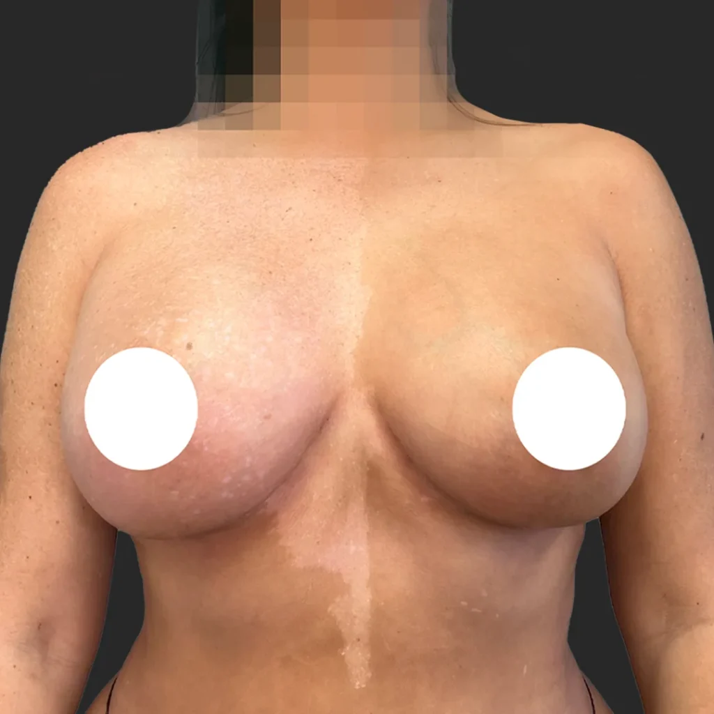 After image