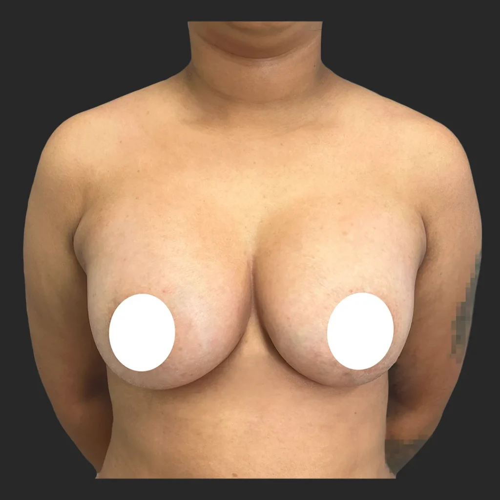 After image