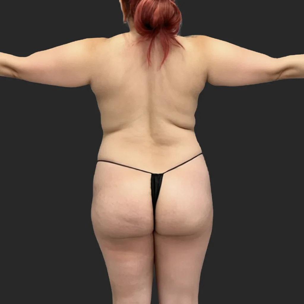 Before image