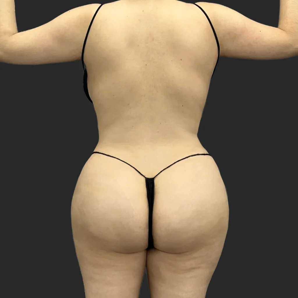 After image