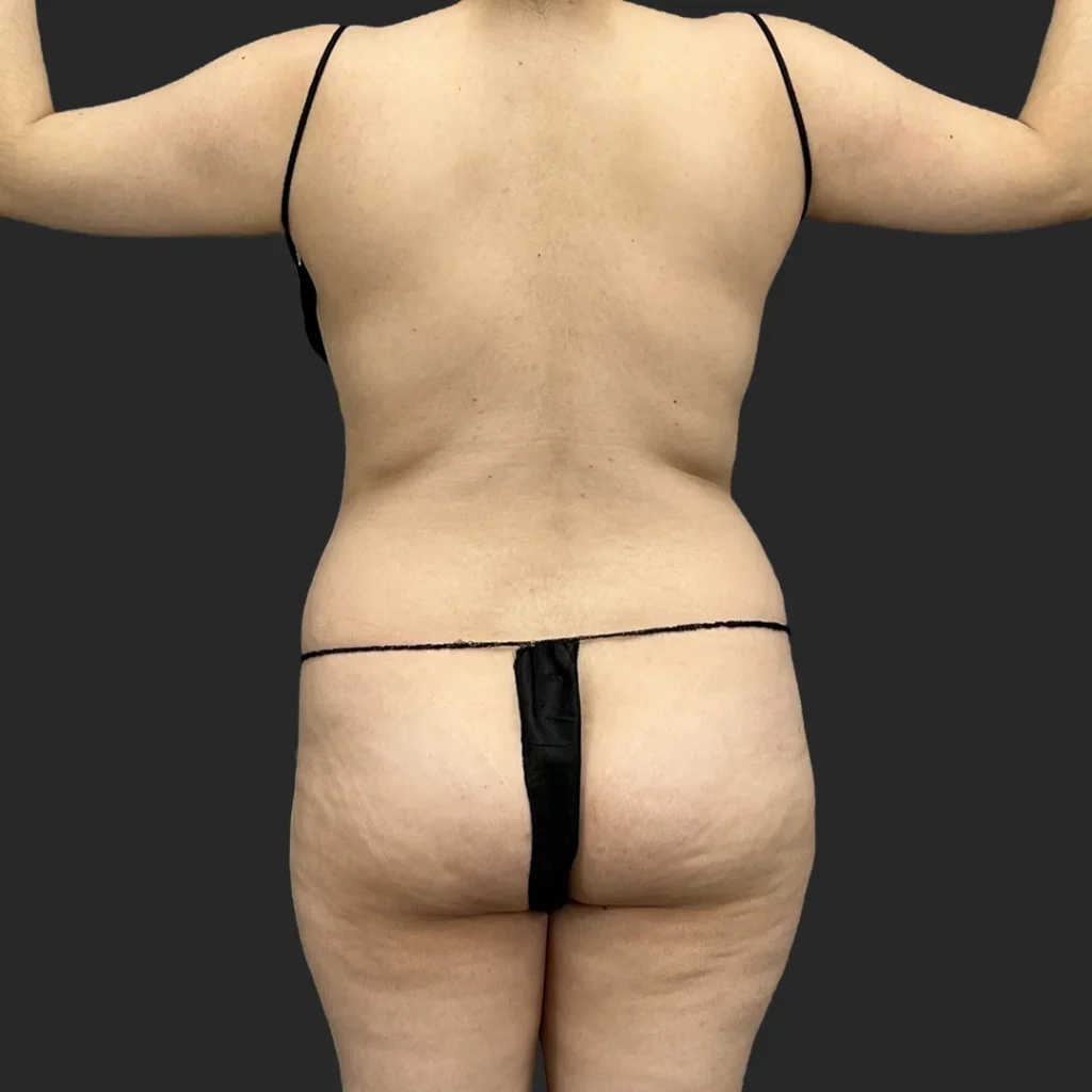 Before image