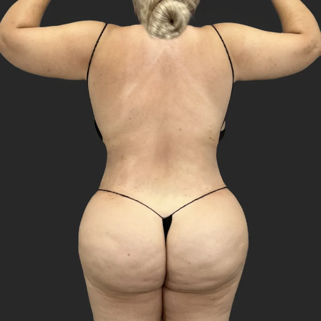 After image