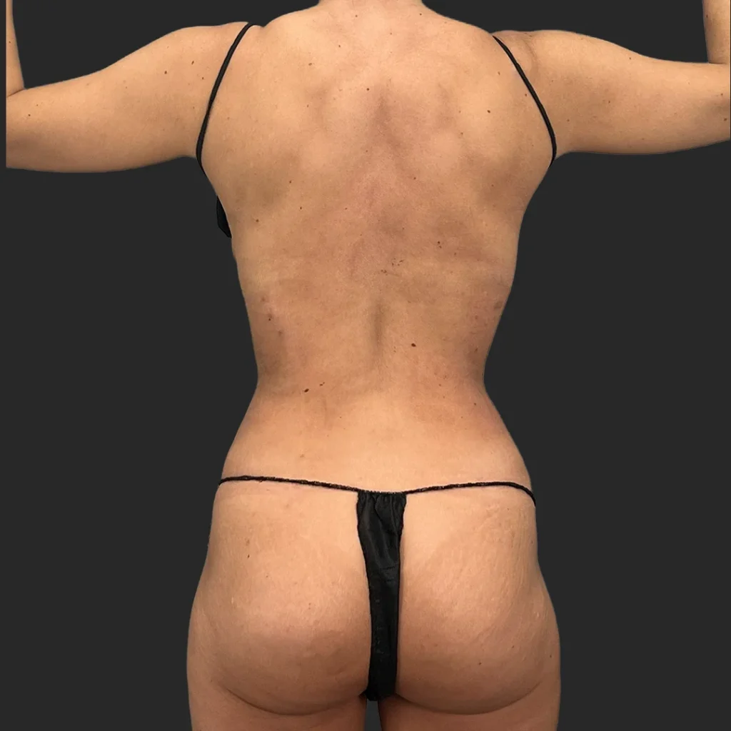 After image