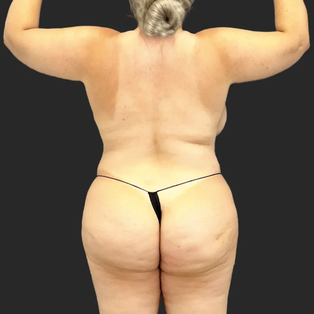 Before image