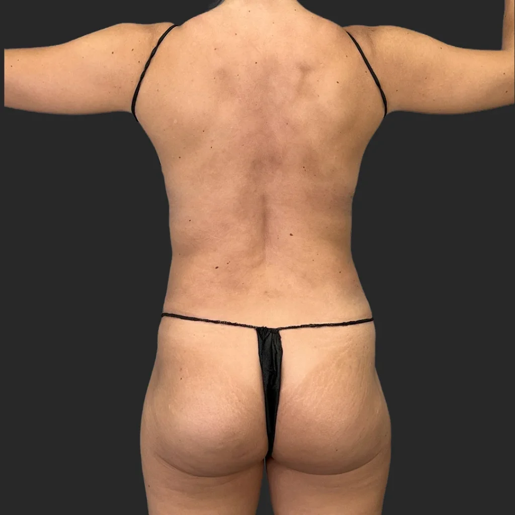 Before image