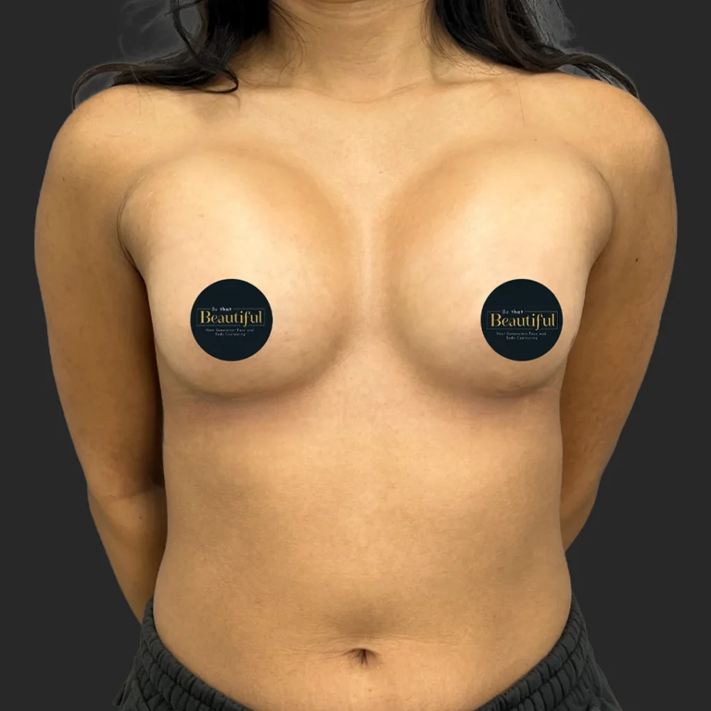 After image