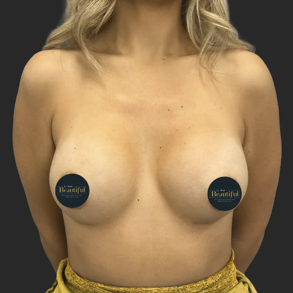 After image