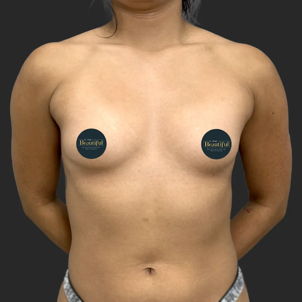 Before image