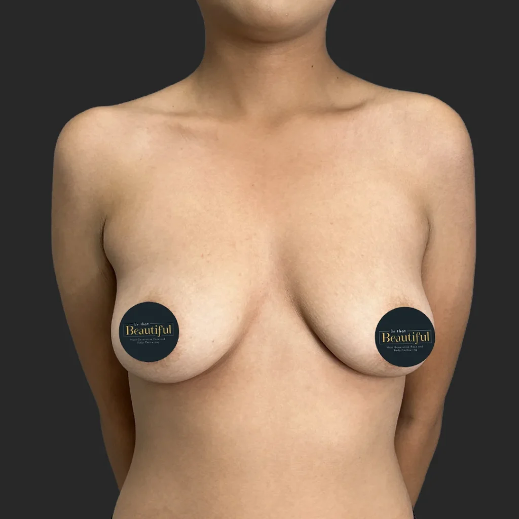 Before image