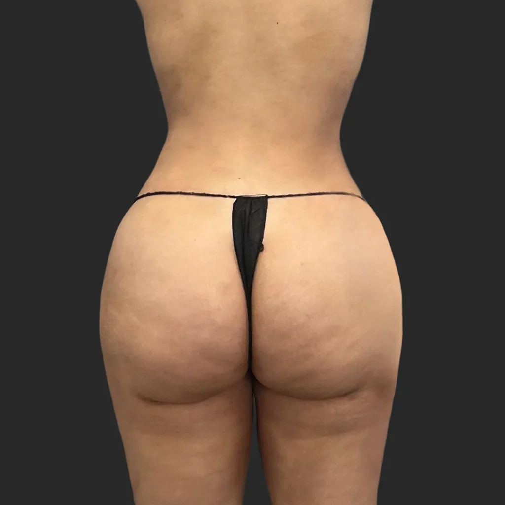 After image