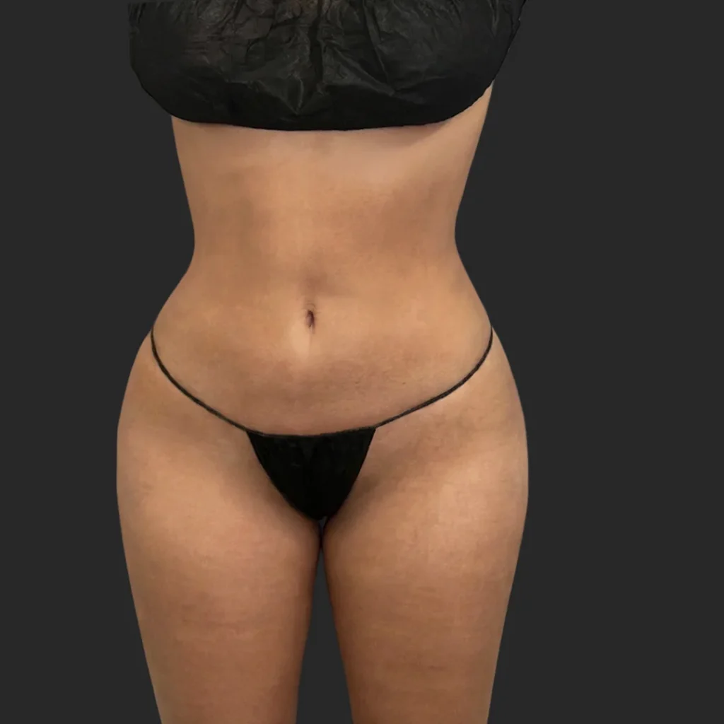 After image