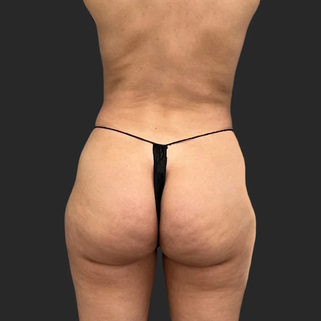 Before image