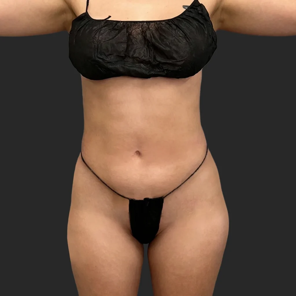 Before image