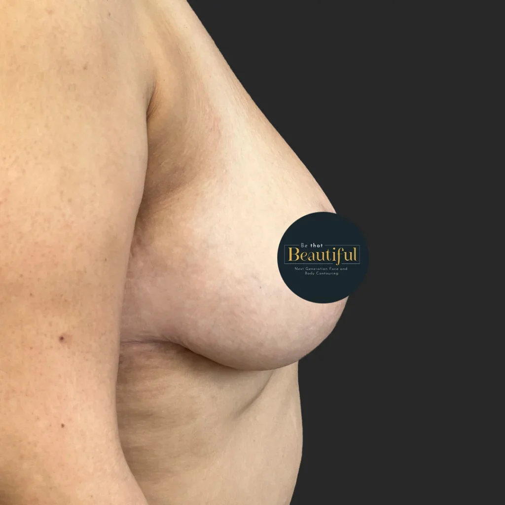 Additional after image