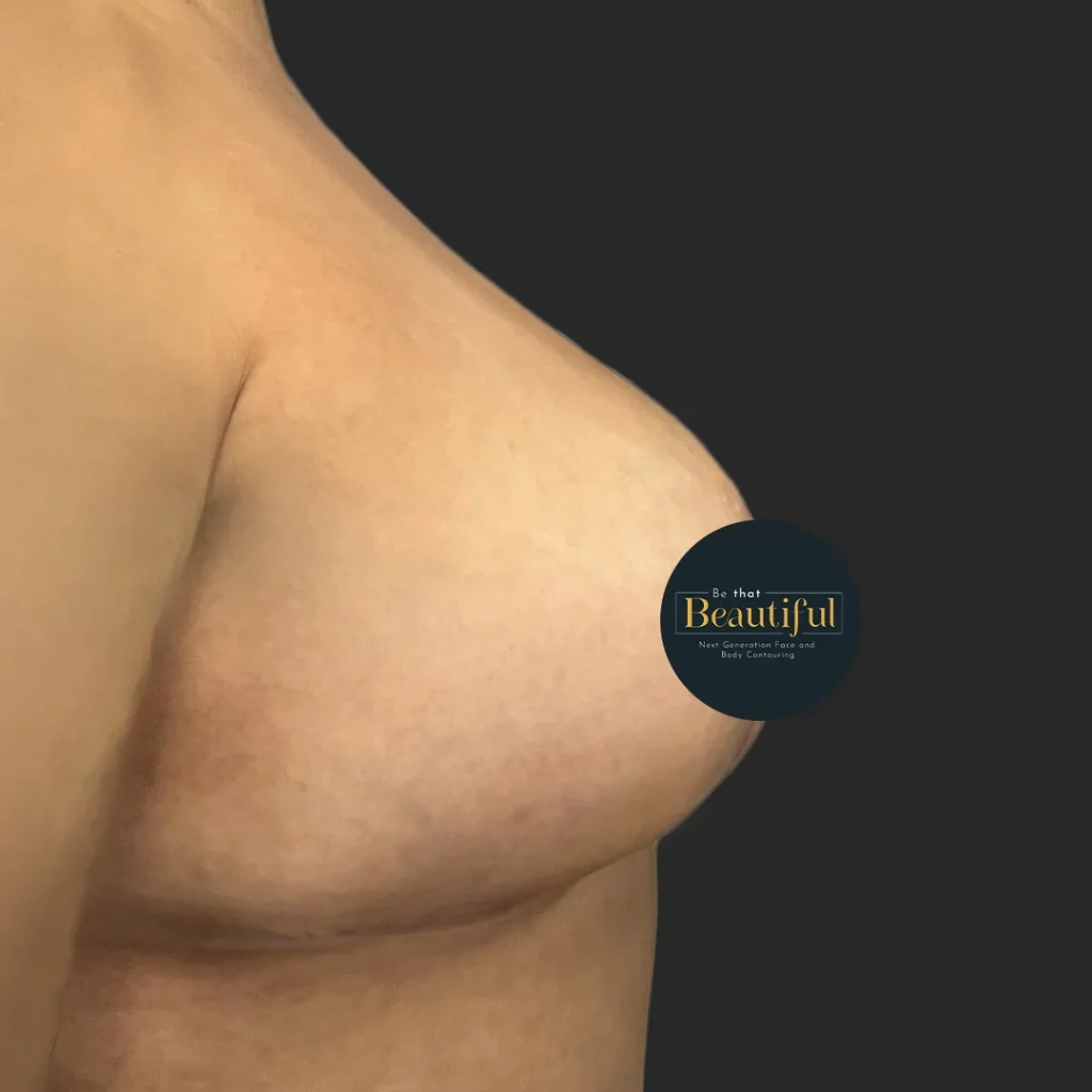 Additional after image