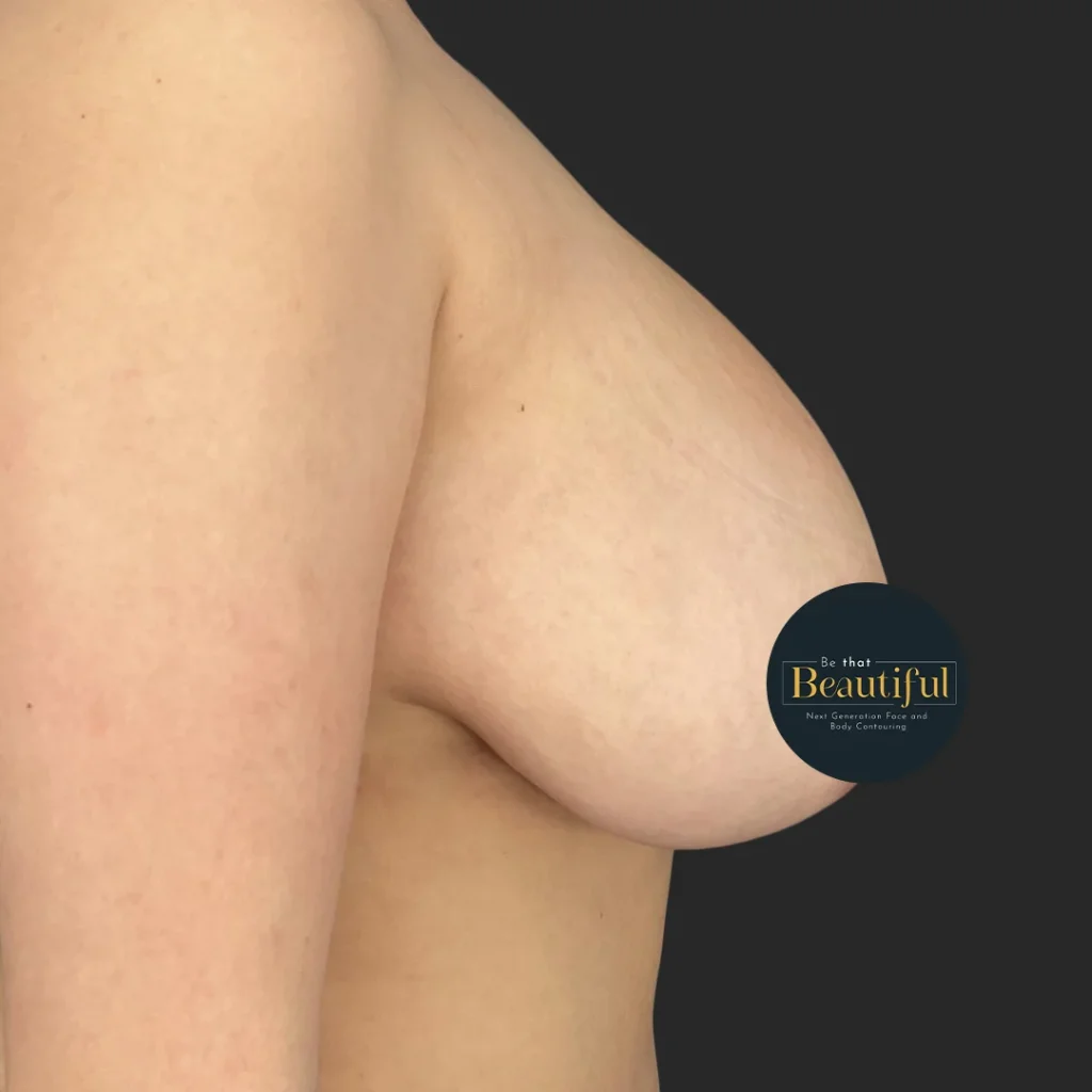 Additional before image