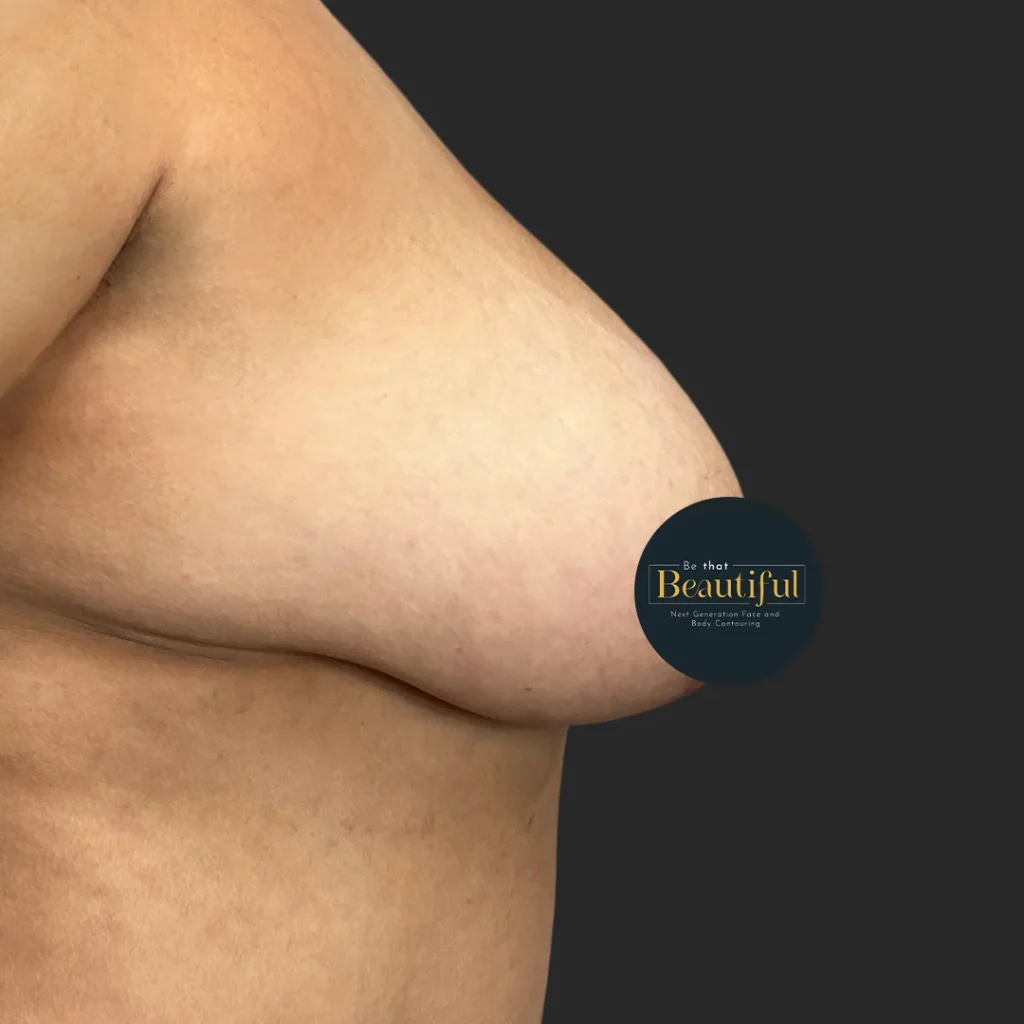 Additional before image