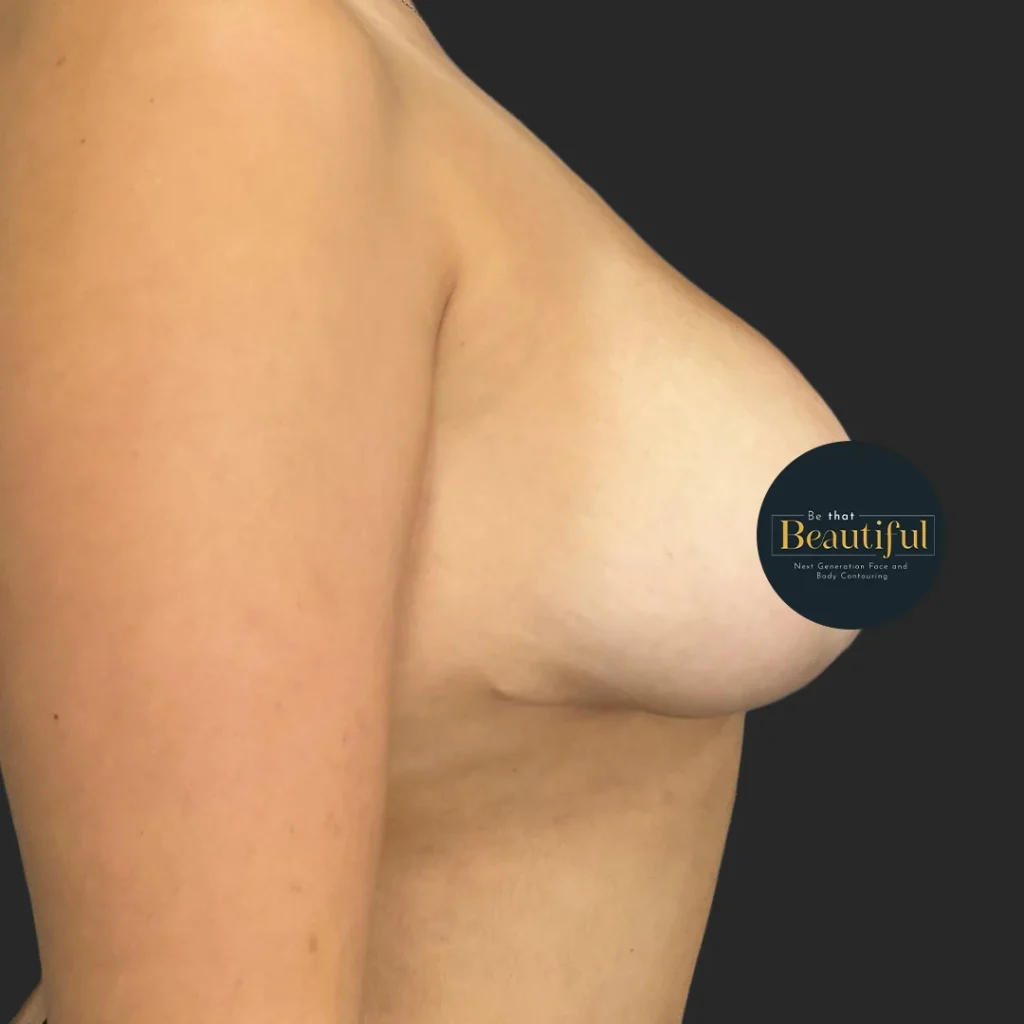 Additional after image