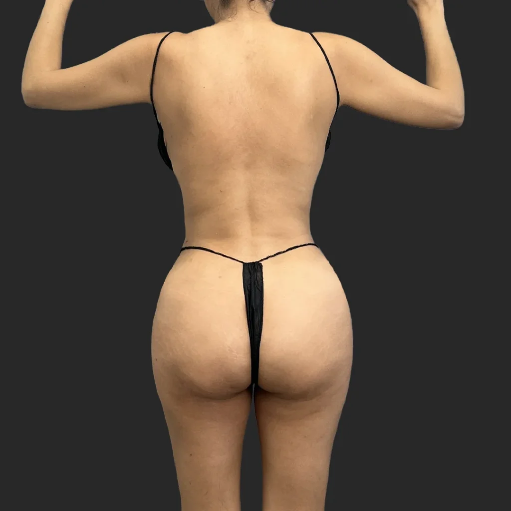 After image