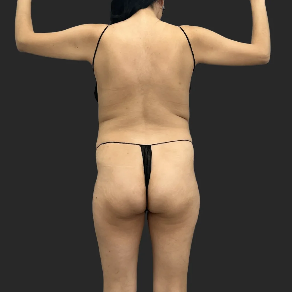 Before image