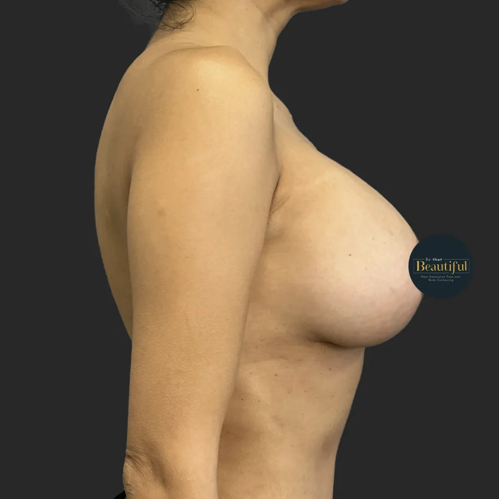Additional after image