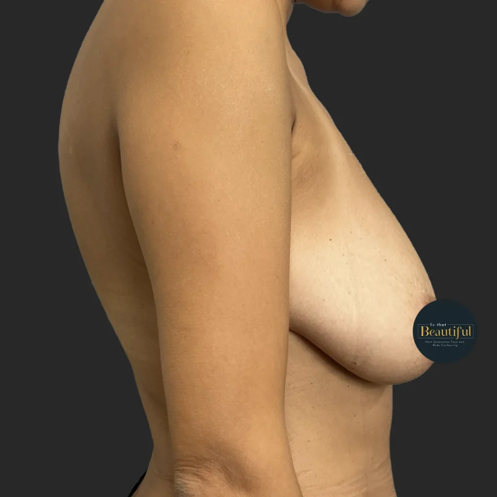 Additional before image