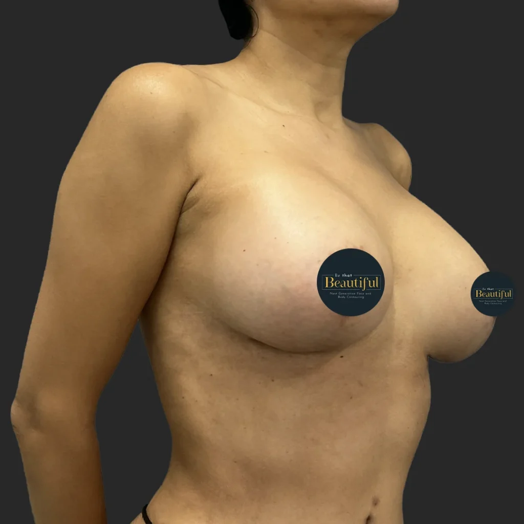 Additional after image