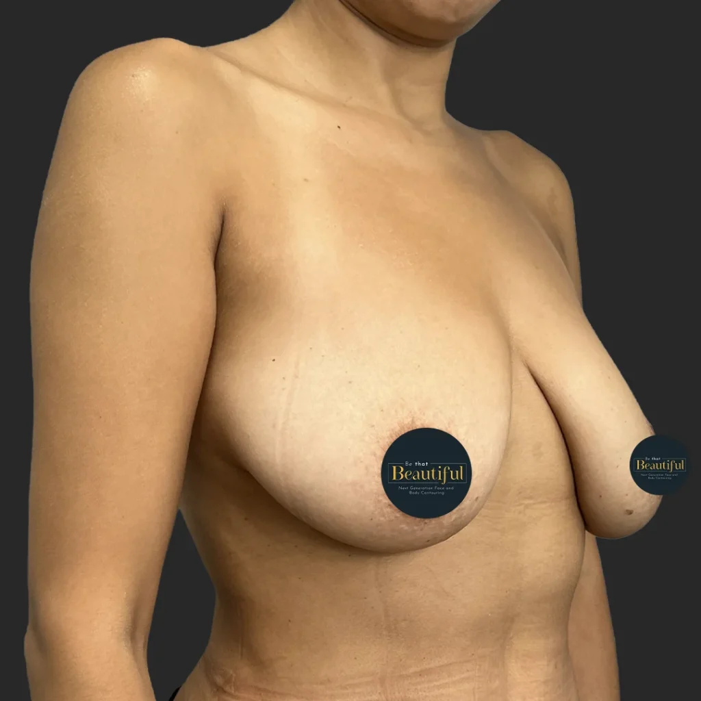 Additional before image