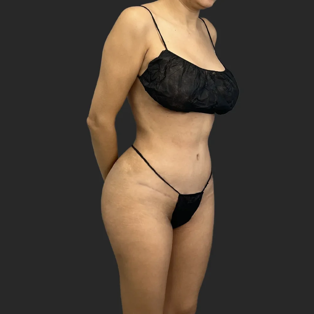 Additional after image