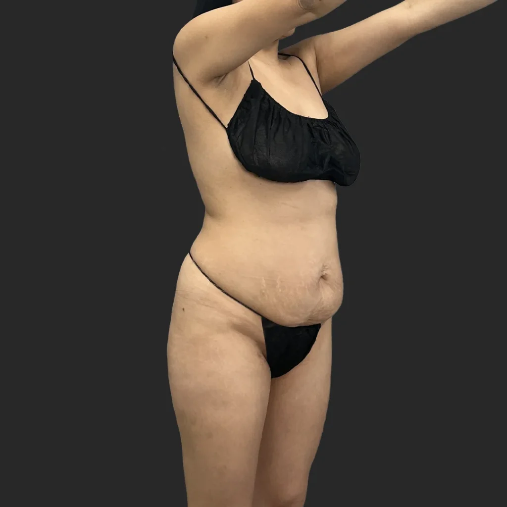 Additional before image
