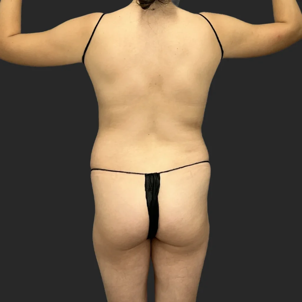 Before image