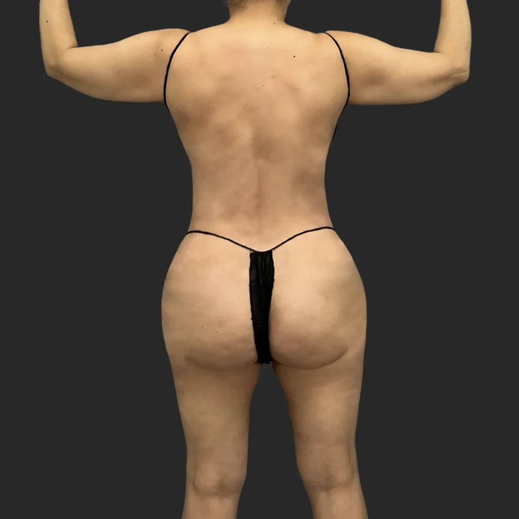 After image